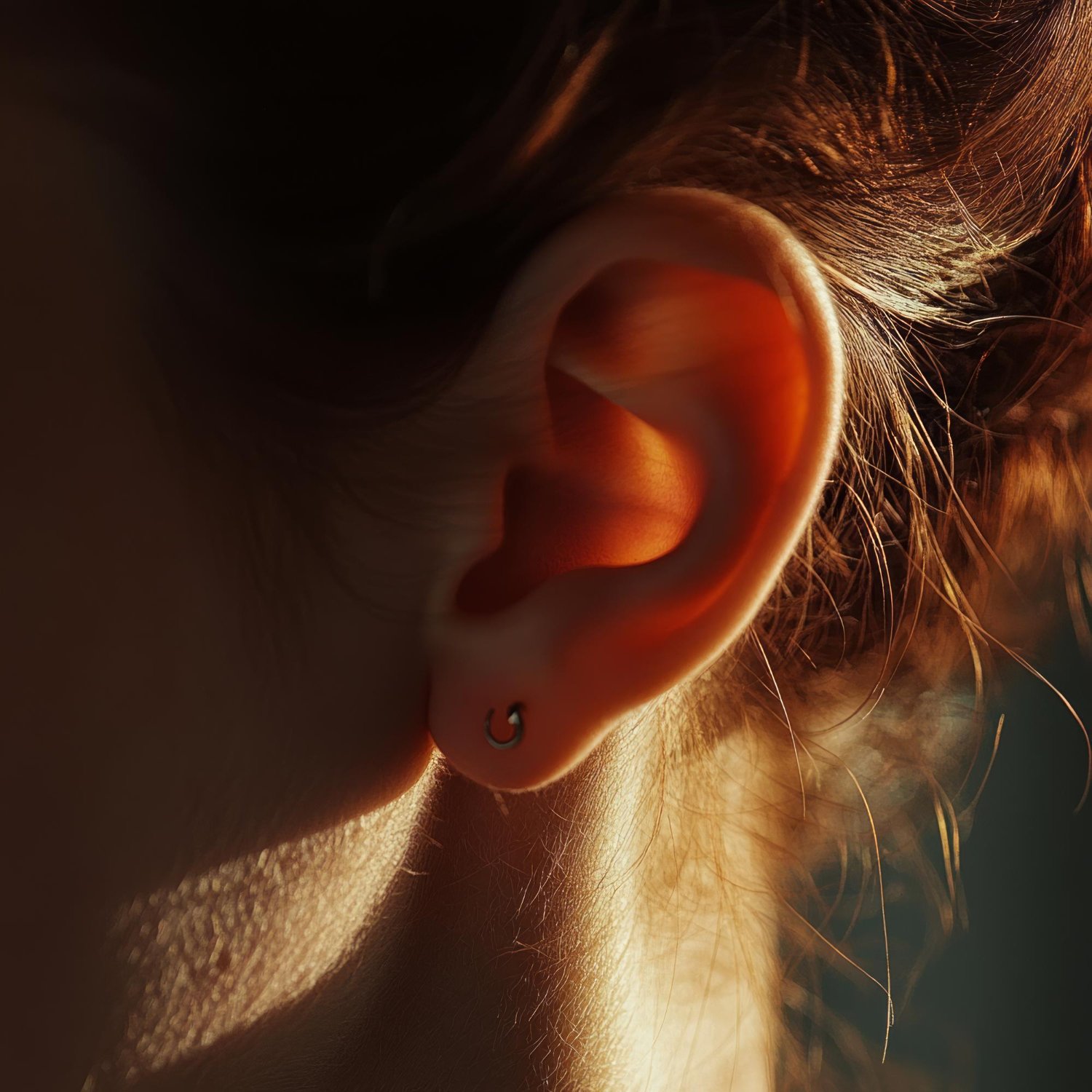 تجميل الأذن الخفاشية