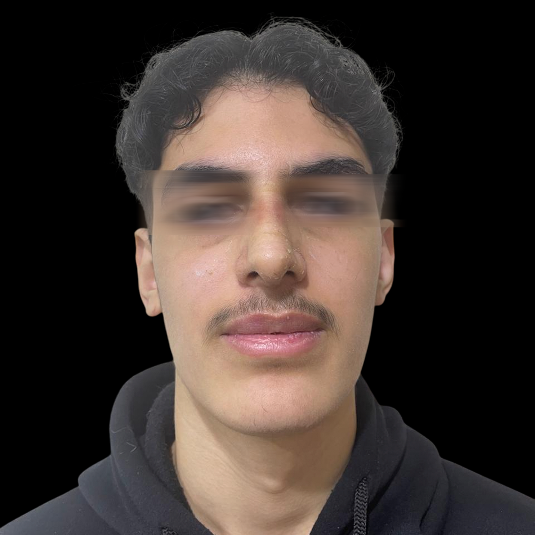 حالات الجبالي