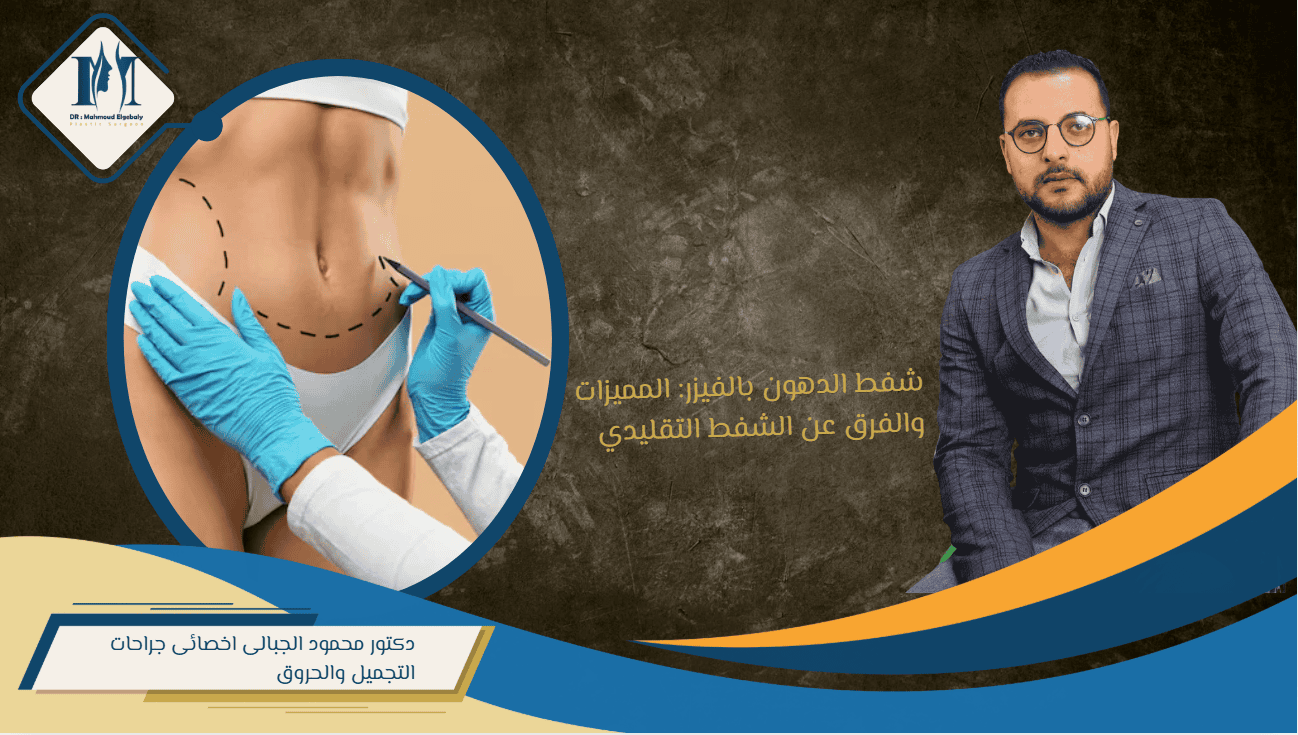 شفط الدهون بالفيزر