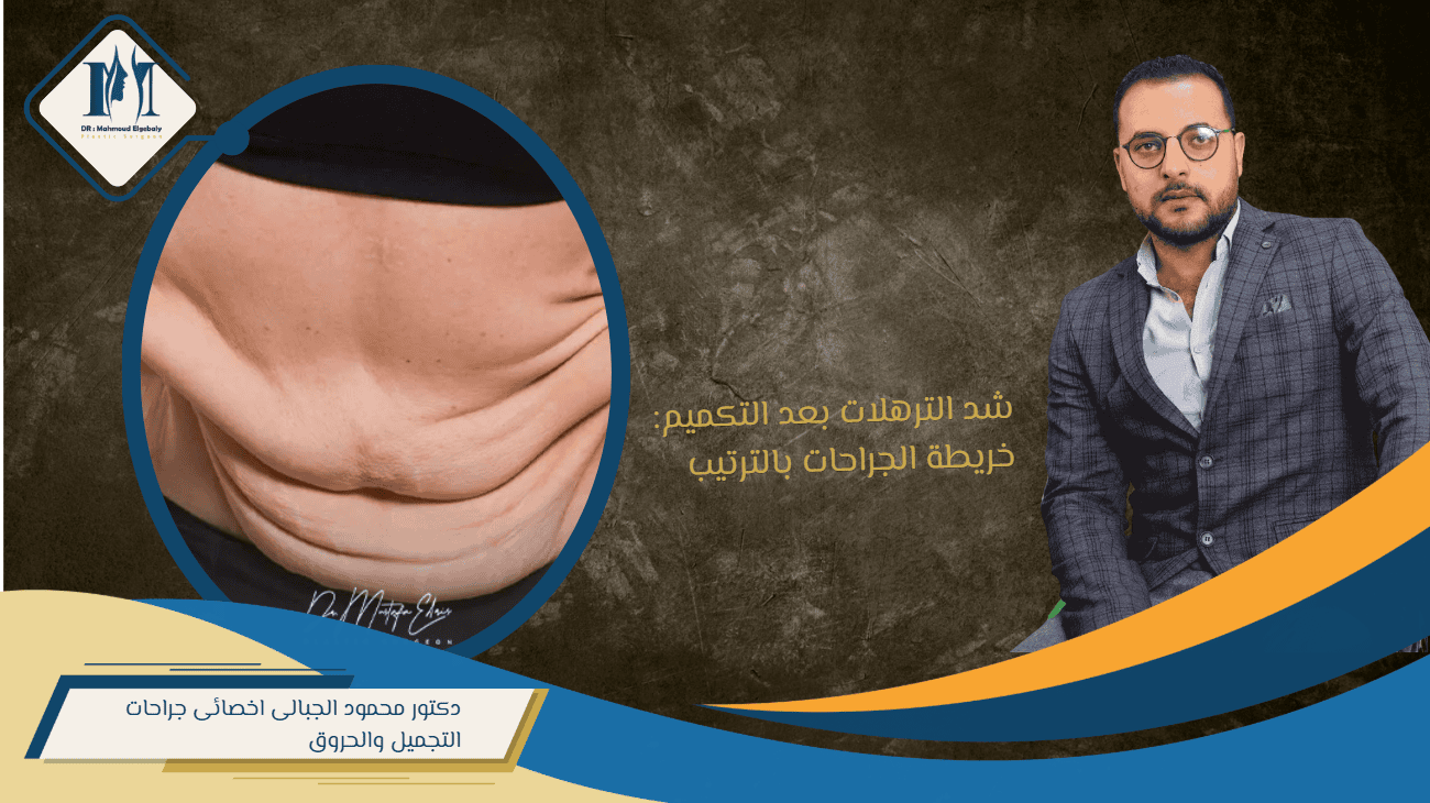 شد الترهلات