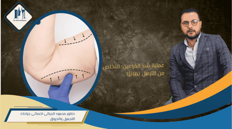 شد الذراعين
