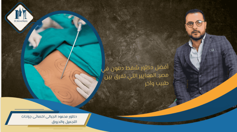 أفضل دكتور شفط دهون في مصر