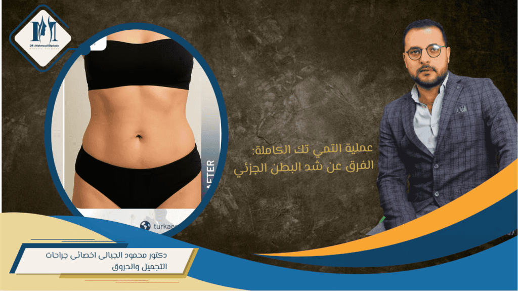 التمي تك