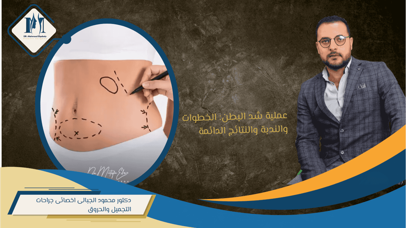 عملية شد البطن