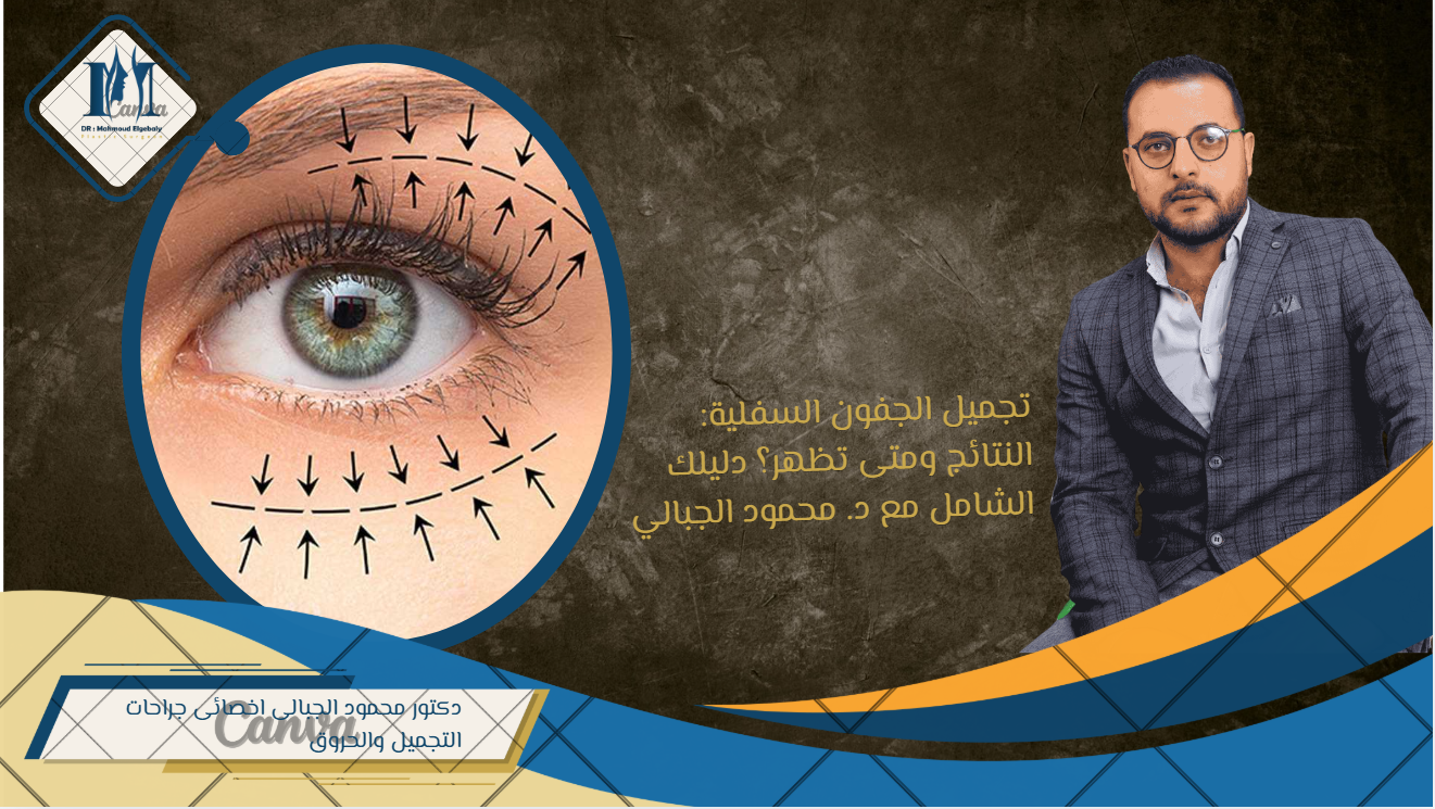 تجميل الجفون السفلية: النتائج ومتى تظهر؟ دليلك الشامل مع د. محمود الجبالي