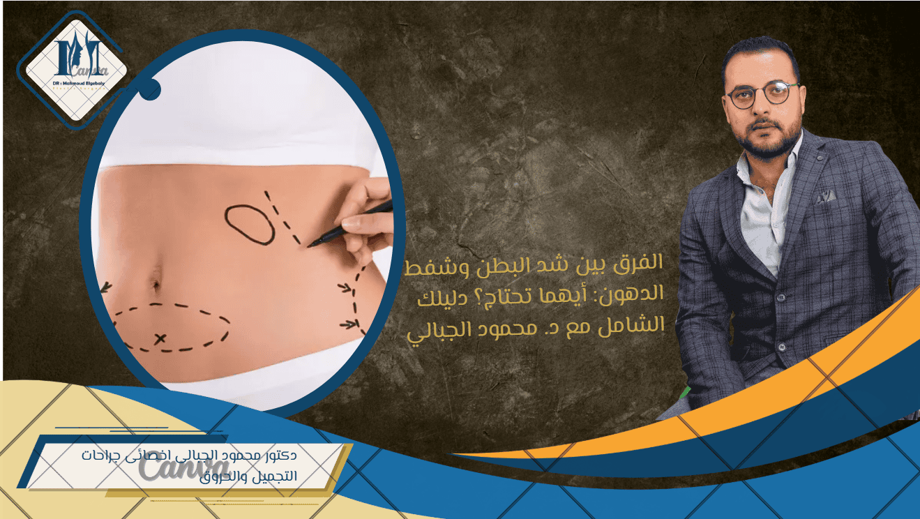الفرق بين شد البطن وشفط الدهون: أيهما تحتاج؟ دليلك الشامل مع د. محمود الجبالي