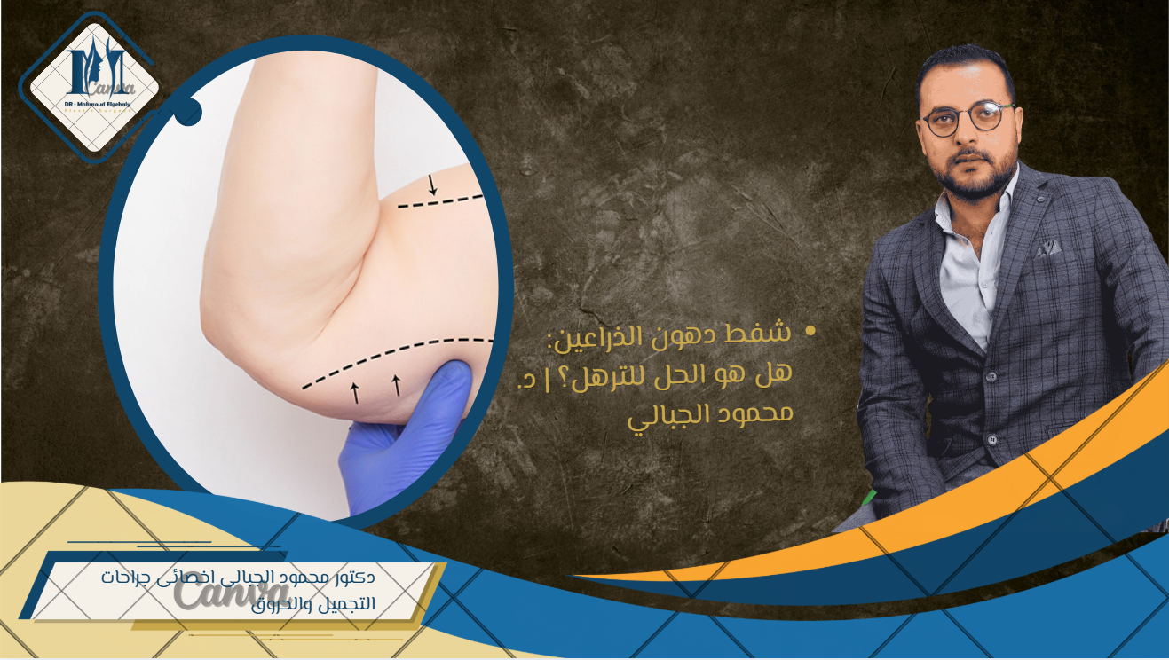 شفط دهون الذراعين: هل هو الحل لترهل الذراعين؟ دليلك الطبي مع د. محمود الجبالي