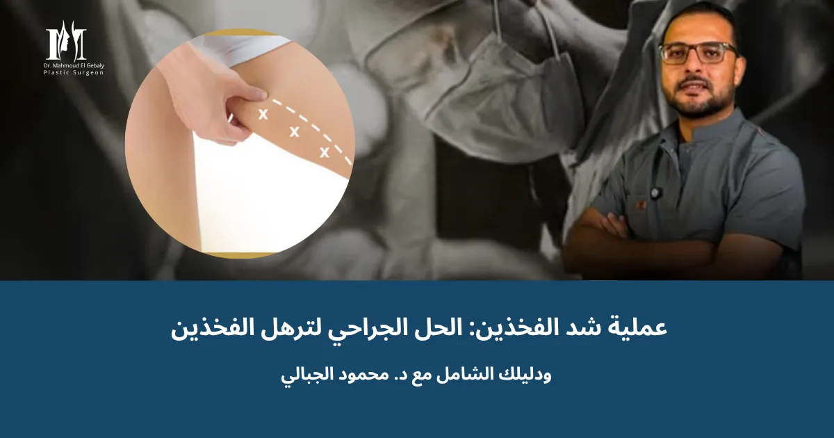 رسم توضيحي لعملية شد الفخذين لإزالة الجلد المترهل بعد فقدان الوزن