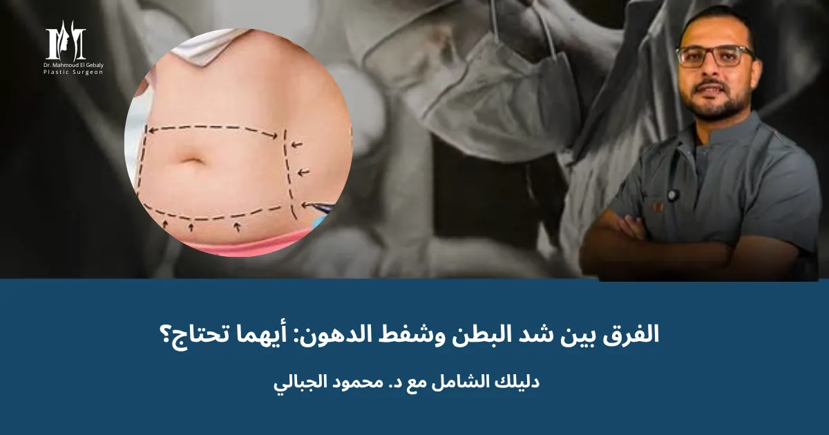 الفرق بين شد البطن وشفط الدهون: أيهما تحتاج؟ دليلك الشامل مع د. محمود الجبالي