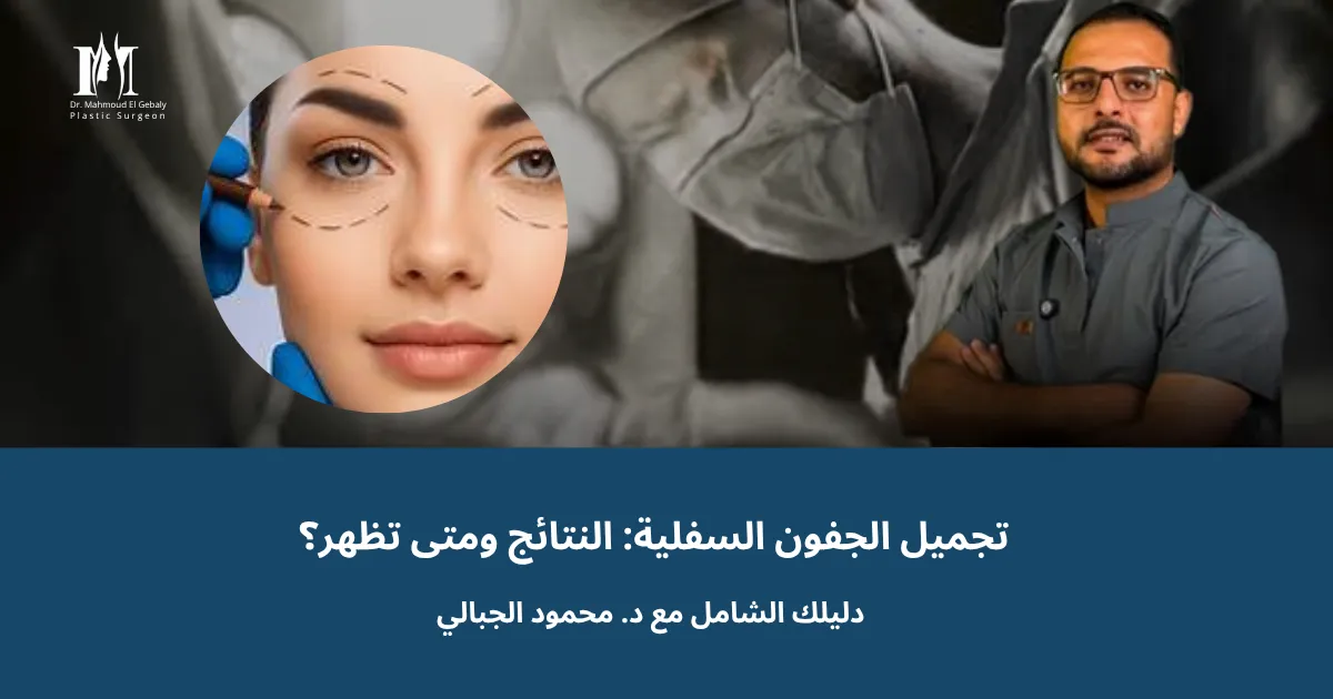 تجميل الجفون السفلية: النتائج ومتى تظهر؟ دليلك الشامل مع د. محمود الجبالي