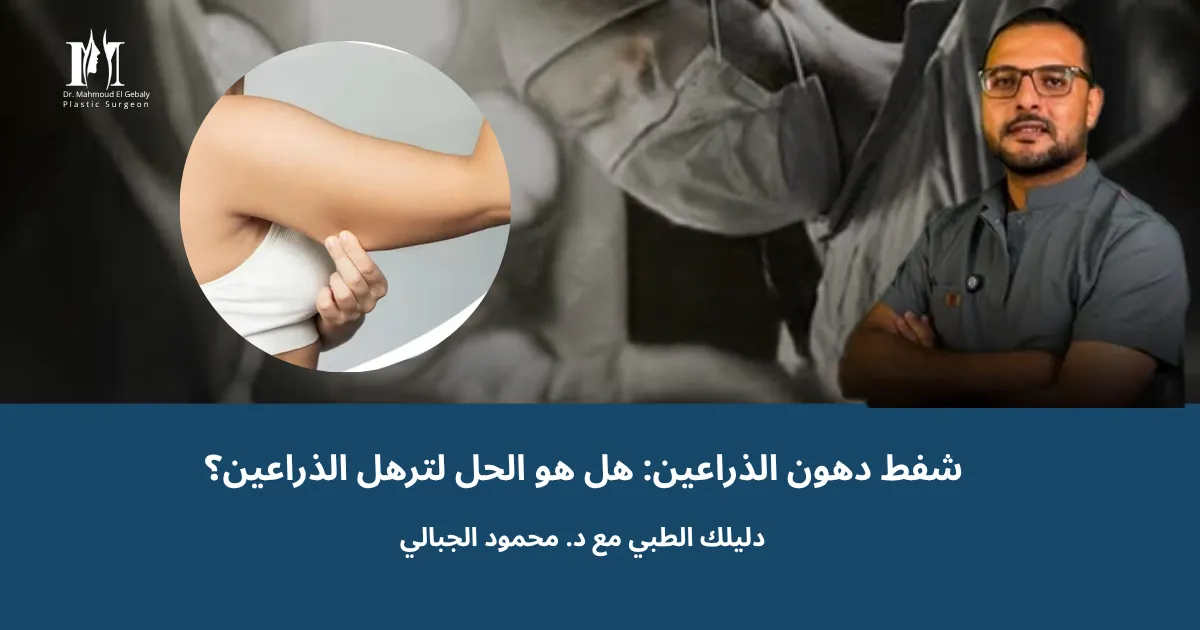 شفط دهون الذراعين: هل هو الحل لترهل الذراعين؟ دليلك الطبي مع د. محمود الجبالي
